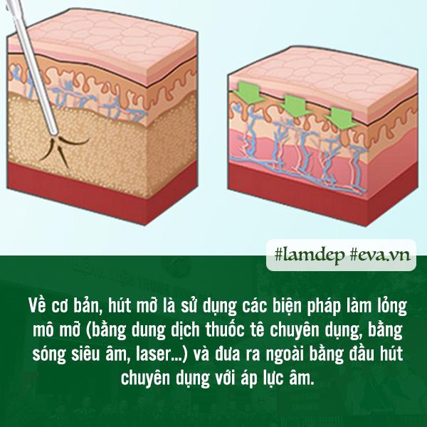 Giảm cân thần kỳ bằng phương pháp hút mỡ, liệu trên đời thực sự có phép màu đó? - 3