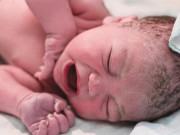 Bà bầu - Giải mã hiện tượng “tràng hoa quấn cổ” thai nhi khiến nhiều mẹ bầu lo lắng