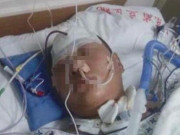 Sức khỏe - Bé trai 6 tuổi vừa thức dậy bỗng đột quỵ, cha mẹ nên lưu ý bộ phận này của trẻ