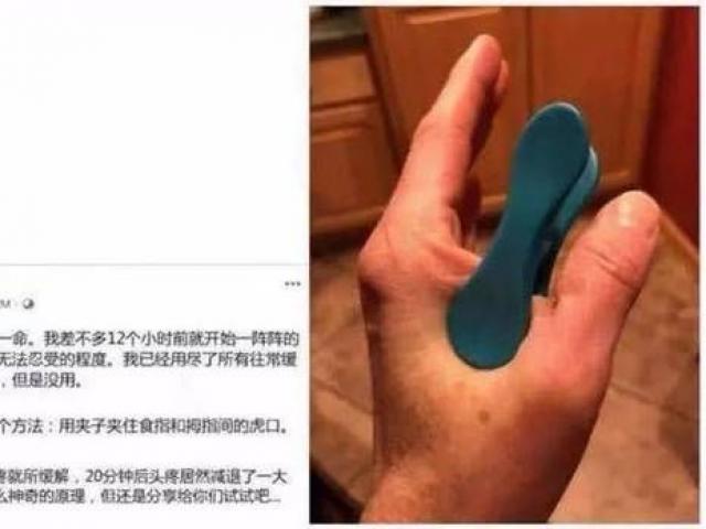Chữa đau đầu bằng một chiếc kẹp, người phụ nữ gây sốt MXH và sự thật về phương pháp này