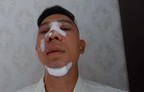 Selfie bên bạn trai với khuôn mặt băng bó chằng chịt, Ngân 98 cũng mới amp;#34;lên đờiamp;#34; nhan sắc? - 2