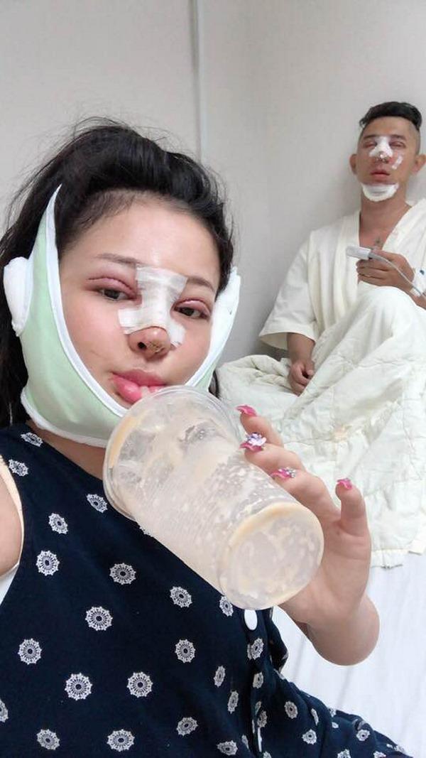 Selfie bên bạn trai với khuôn mặt băng bó chằng chịt, Ngân 98 cũng mới amp;#34;lên đờiamp;#34; nhan sắc? - 3