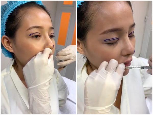 Selfie bên bạn trai với khuôn mặt băng bó chằng chịt, Ngân 98 cũng mới amp;#34;lên đờiamp;#34; nhan sắc? - 5