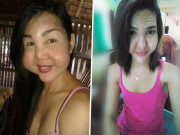 Làm đẹp - Rủ nhau đi PTTM cùng 1 lò, 2 cô gái gia nhập hội những người... mặt dị nhất hành tinh