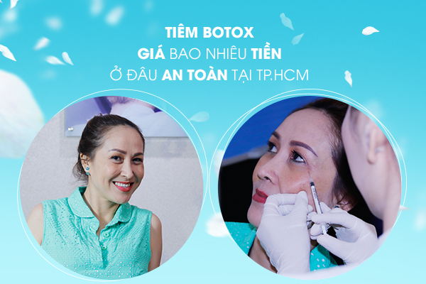 Tiêm Botox ở đâu an toàn, giá bao nhiêu tiền tại TPHCM? - 1