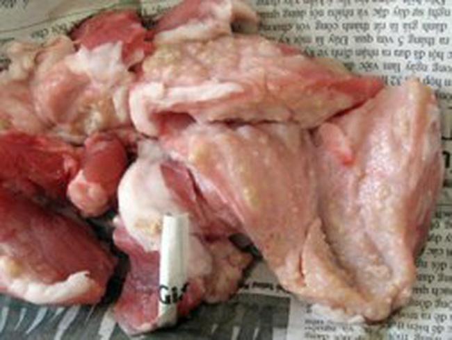 Trẻ nhiễm sán lợn: amp;#34;Xét nghiệm máu là vô ích nếu trẻ chưa có biểu hiện lâm sàng của bệnhamp;#34; - 1