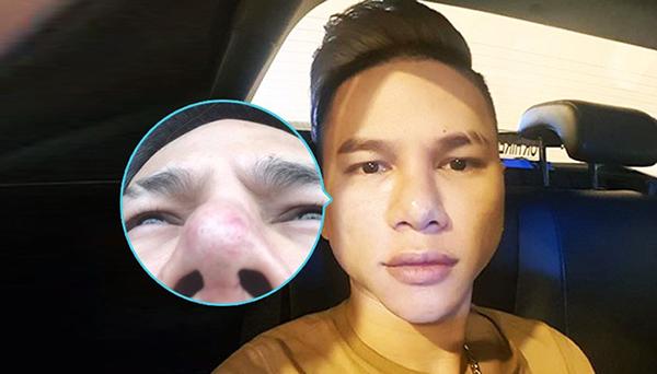 Nghiện thẩm mỹ, nhiều sao Việt chẳng thể thăng hạng nhan sắc, thậm chí còn hoá amp;#34;thảm hoạamp;#34; - 5