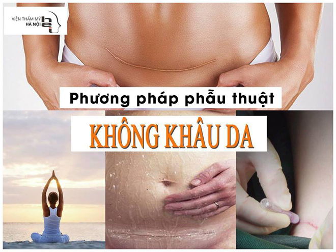 Phẫu thuật không khâu da – Giải pháp trọn vẹn cho lĩnh vực phẫu thuật thẩm mỹ - 2