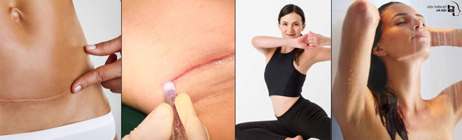 Phẫu thuật không khâu da – Giải pháp trọn vẹn cho lĩnh vực phẫu thuật thẩm mỹ - 5