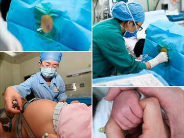 Theo chân nữ bác sĩ đi   đẻ thường không đau  , thoải mái tô son trước khi rặn đẻ