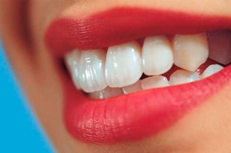 “Cái răng, cái tóc là góc con người”. Nhiều người sở hữu cặp răng cửa to hay còn gọi là răng thỏ thường không tự tin vì cho rằng điều này ảnh hưởng tới thẩm mỹ.
