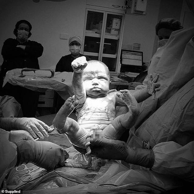 Bé trai chào đời với biểu cảm như siêu nhân: amp;#39;Anh đến để giải cứu thế giớiamp;#39; - 1