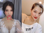 Làm đẹp - Sau ồn ào văng tục tại tòa, Lưu Đê Ly tiếp tục lộ cằm nhọn lệch hẳn sang một bên