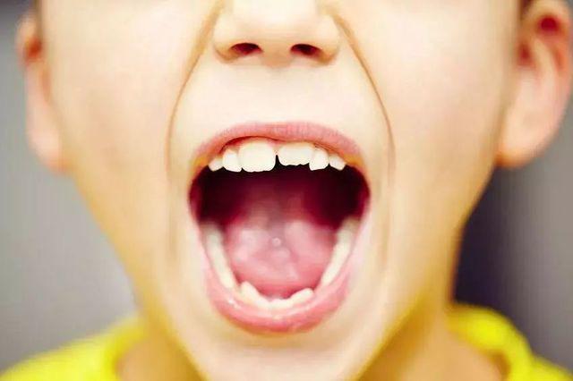 uong loai nuoc nay moi ngay khien ham rang cua cau be 2 tuoi bi hu hai nghiem trong - 4