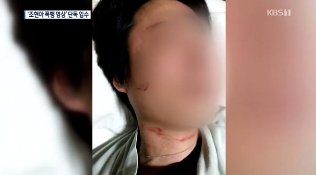 Ái nữ tập đoàn hàng không lớn nhất HQ: Coi người như cỏ rác, đánh chồng con không thương tiếc - 5