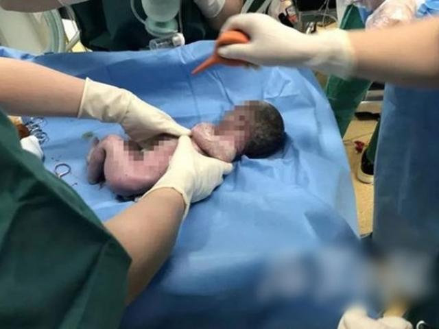 Thai phụ bị tiền sản giật, con chào đời bị ngưng tim, 1 giờ sau điều kỳ diệu xảy ra