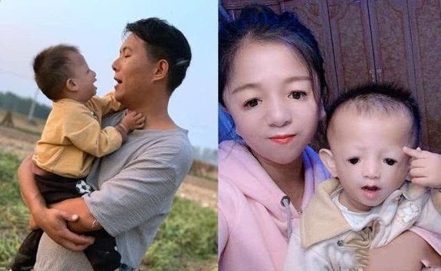 Cố sinh con thứ 2 dù mẹ mắc bệnh di truyền, cặp đôi ngỡ ngàng khi nhìn mặt con - 2