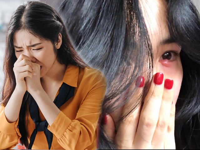 Tẩy trang không đúng cách, Hòa Minzy cuống cuồng cầu cứu CĐM cách chữa đôi mắt sưng phồng
