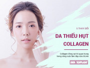 Làm đẹp - 5 dấu hiệu nhận biết làn da của bạn đang thiếu hụt collagen trầm trọng