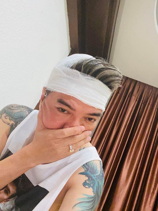 Đàm Vĩnh Hưng đầu đầy máu, bức xúc vì gặp tai nạn bất ngờ trên sân khấu dịp cận Tết - 6