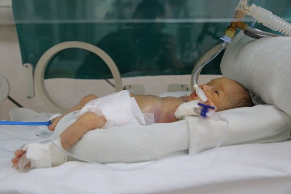 Mang song thai đẻ rơi tại nhà, sau nửa tháng người mẹ đau xót khi một con không qua khỏi - 1