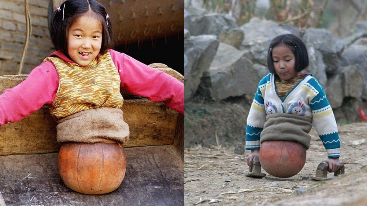 Cô bé bóng rổ cụt nửa người từng khiến cả thế giới cảm phục ...