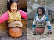 Tin tức - "Cô bé bóng rổ" cụt nửa người từng khiến cả thế giới cảm phục giờ ra sao?