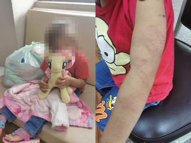 Chồng mới không thích con riêng, bé gái bị mẹ bỏ trước nhà tình thương trong tình trạng đáng sợ