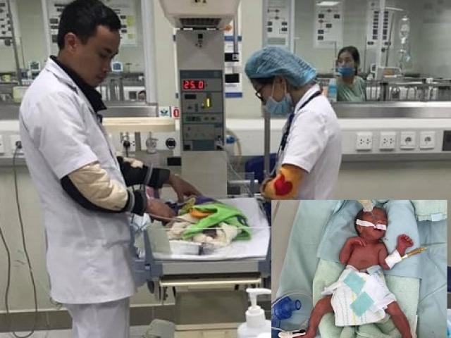 Cận Tết, bác sĩ kể hành trình gần 600km giành sự sống cho bé sinh non nhỏ bằng cái cốc