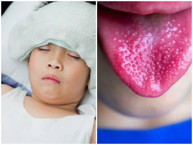 Mẹ tin lời bác sĩ Google khi thấy con bị sốt khiến đứa trẻ bị tổn thương tim nghiêm trọng