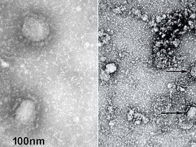 Công bố những hình ảnh đầu tiên của virus viêm phổi lạ gây chết người ở Vũ Hán