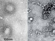 Tin tức - Công bố những hình ảnh đầu tiên của virus viêm phổi lạ gây chết người ở Vũ Hán