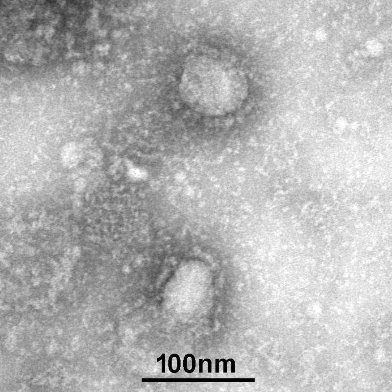 Công bố những hình ảnh đầu tiên của virus viêm phổi lạ gây chết người ở Vũ Hán - 2