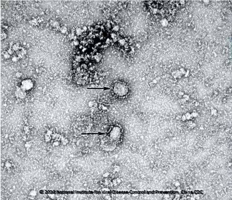 Công bố những hình ảnh đầu tiên của virus viêm phổi lạ gây chết người ở Vũ Hán - 1