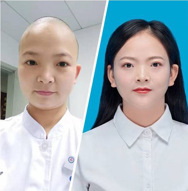 Những người hùng áo blouse trắng đang chiến đấu với virut corona: Cạo tóc, mặc bỉm tiết kiệm thời gian - 1