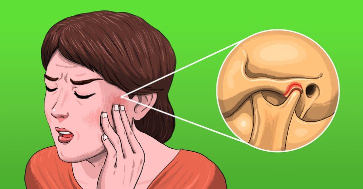 5 nguyên nhân gây đau răng mà không phải do vấn đề răng miệng - 1