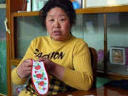 Sức khỏe - Người phụ nữ suýt chết vì uống quá nhiều vitamin C để chữa nám, tàn nhang