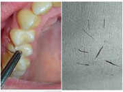 Sức khỏe - Người phụ nữ liên tục mọc lông ở vị trí bất thường khiến các bác sĩ bó tay