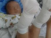 Tin tức - Phẫn nộ lời khai của gã cha đánh con 4 tháng xuất huyết não, gãy 2 chân