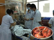 Sức khỏe - Người đỏ như tôm luộc sau khi ăn hải sản, bác sĩ lý giải nguyên nhân và cách phòng tránh