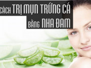 Làm đẹp - 15 cách trị mụn trứng cá tại nhà bằng thiên nhiên an toàn hiệu quả nhất