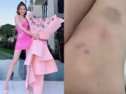 Làm đẹp - Đôi chân làm nên thương hiệu của Ngọc Trinh hết bị soi gân guốc lại bầm tím bất thường