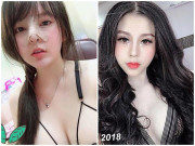 Làm mẹ - 3 hotgirl MXH chi tiền tỉ "đập mặt xây lại", sinh con ra càng lớn càng đẹp lạ kì