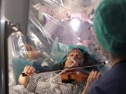 Clip Eva - Chuyện hy hữu: Nữ bệnh nhân đang phẫu thuật não vẫn kéo đàn violin