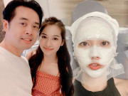 Làm đẹp - Cứ tưởng hoàn hảo, hóa ra làn da bà xã Dương Khắc Linh cũng có chi chít mụn ẩn