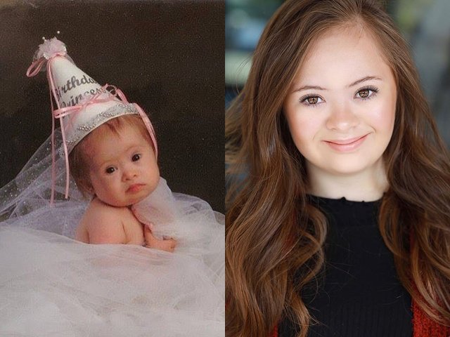 Bác sĩ khẳng định không có tương lai, bé gái mắc hội chứng Down sau 15 năm giờ ra sao?