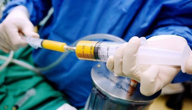 Từ vụ cháu tỷ phú Hông Kông chết vì hút mỡ nâng ngực, cảnh giác những biến chứng nguy hiểm - 2