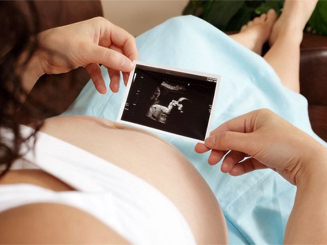 Mẹ bầu phấn khích khi thấy thai nhi cười khi siêu âm nhưng bác sĩ lại lắc đầu - 1