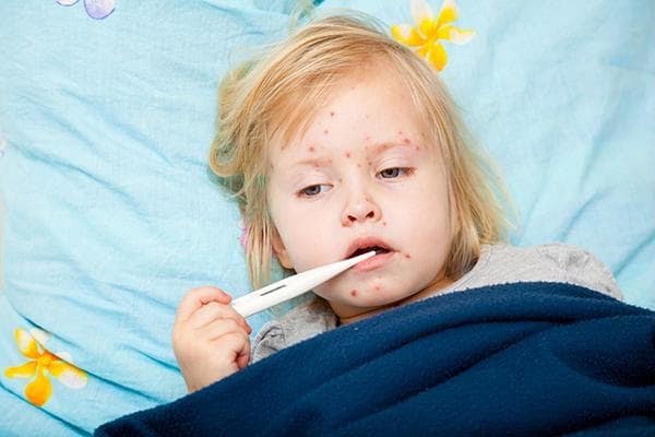 Nguyên nhân sốt siêu vi ở trẻ em là gì và các mẹo chữa sốt an toàn cho trẻ - 2