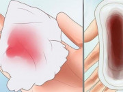 Chuẩn bị mang thai - Uống thuốc tránh thai khẩn cấp bị ra máu là bị làm sao?